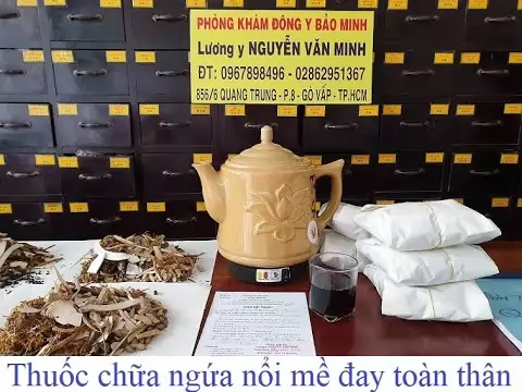 Nổi mề đay ở trẻ em và thuốc trị nổi mề đay cho trẻ