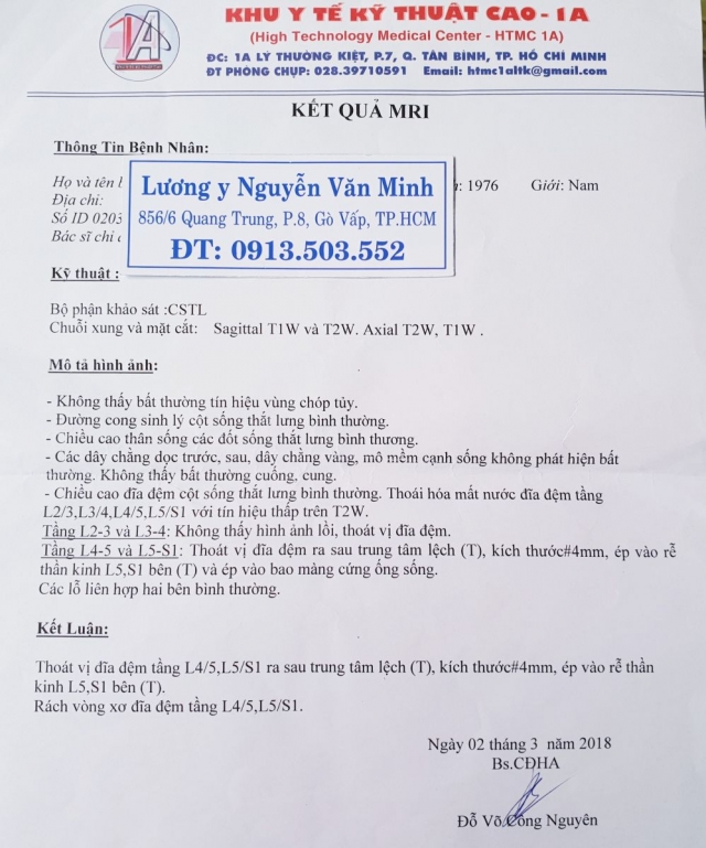 Thoát vị đĩa đệm cột sống thắt lưng